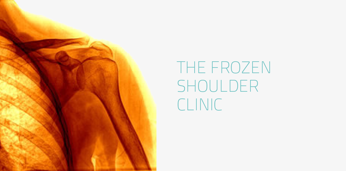 The Shoulder Clinic – Frozen Shoulder